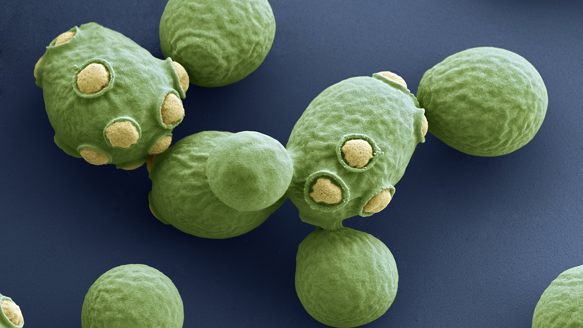 Представитель Класса Saccharomycetes